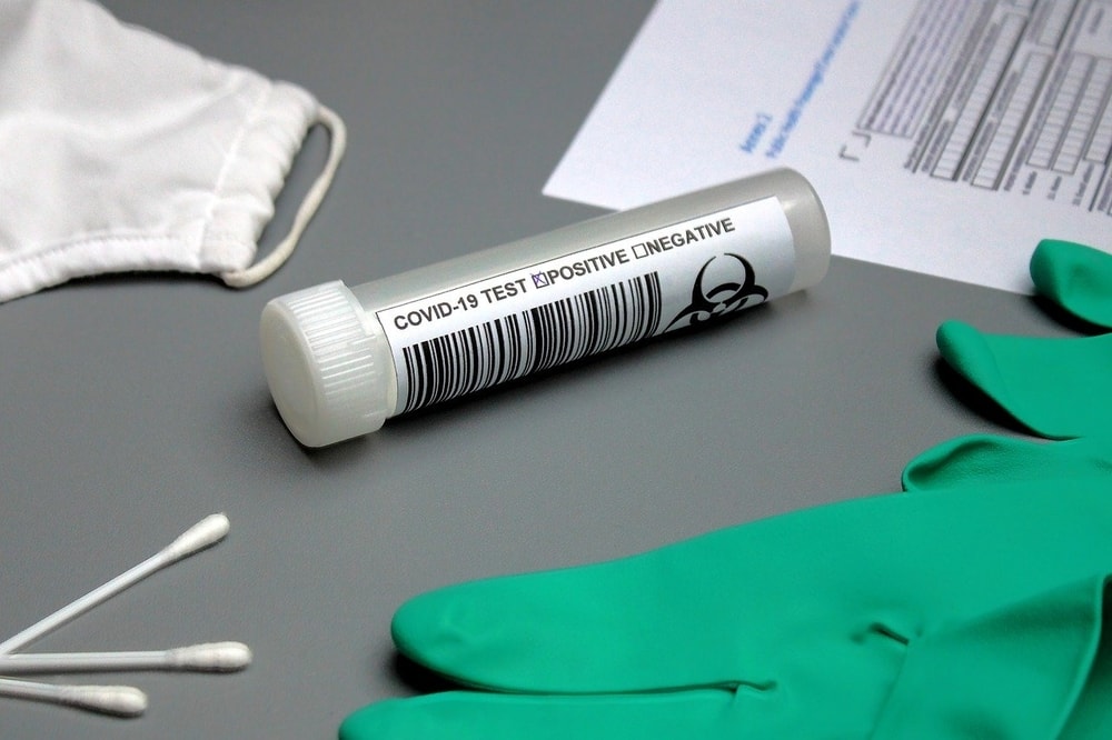 Test sierologici su docenti: screening volontari dal 24 agosto al 5 settembre